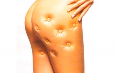 Аппаратное лечение целлюлита