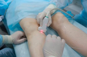 Аппаратные методы лечения варикоза