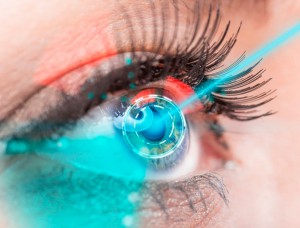 Что нужно знать, решаясь на лазерную коррекцию зрения