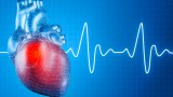 Физиотерапия для сердца Физиотерапия для сердца