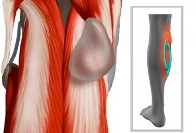 Как лечить кисту Бейкера, чтобы избежать операции