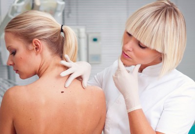 Как удалить папилломы на лице?