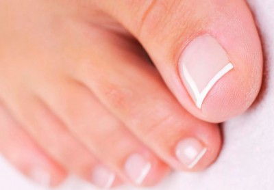 Лечение вросшего ногтя дома