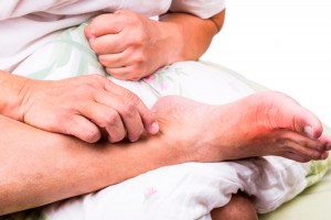 Подагра – болезнь королей